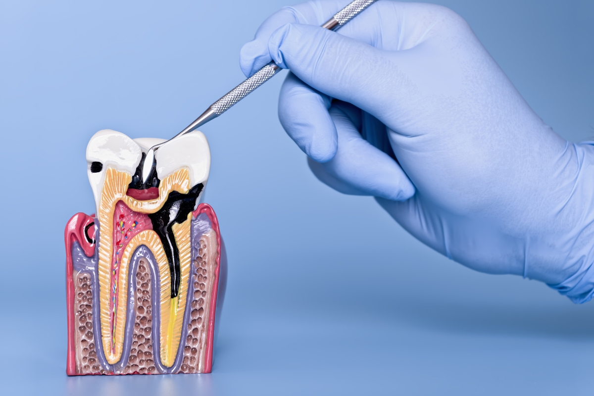 Periodontal Maintenance
